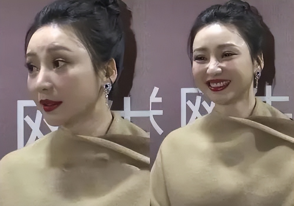 盘点因为整容重回颜值巅峰的明星,眼睛有点歪的明星