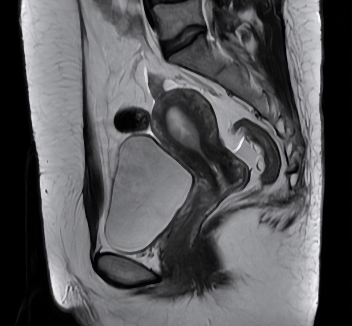 hpv16感染七年,hpv16感染tct正常活检正常多久复查