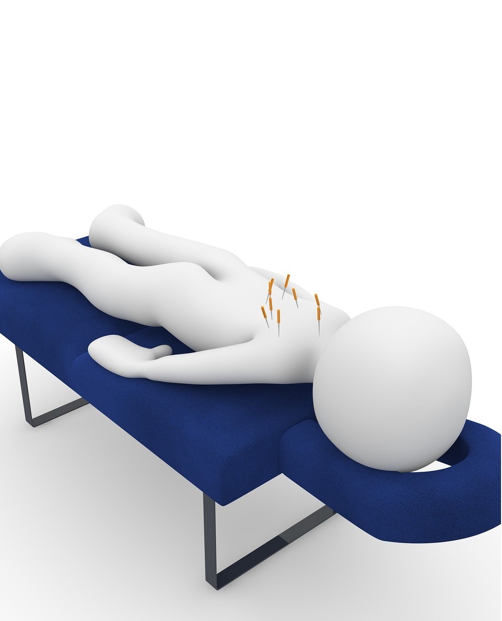 颈椎痛做了针灸可以接着按摩吗,颈椎针灸完疼痛感加重反而好得快