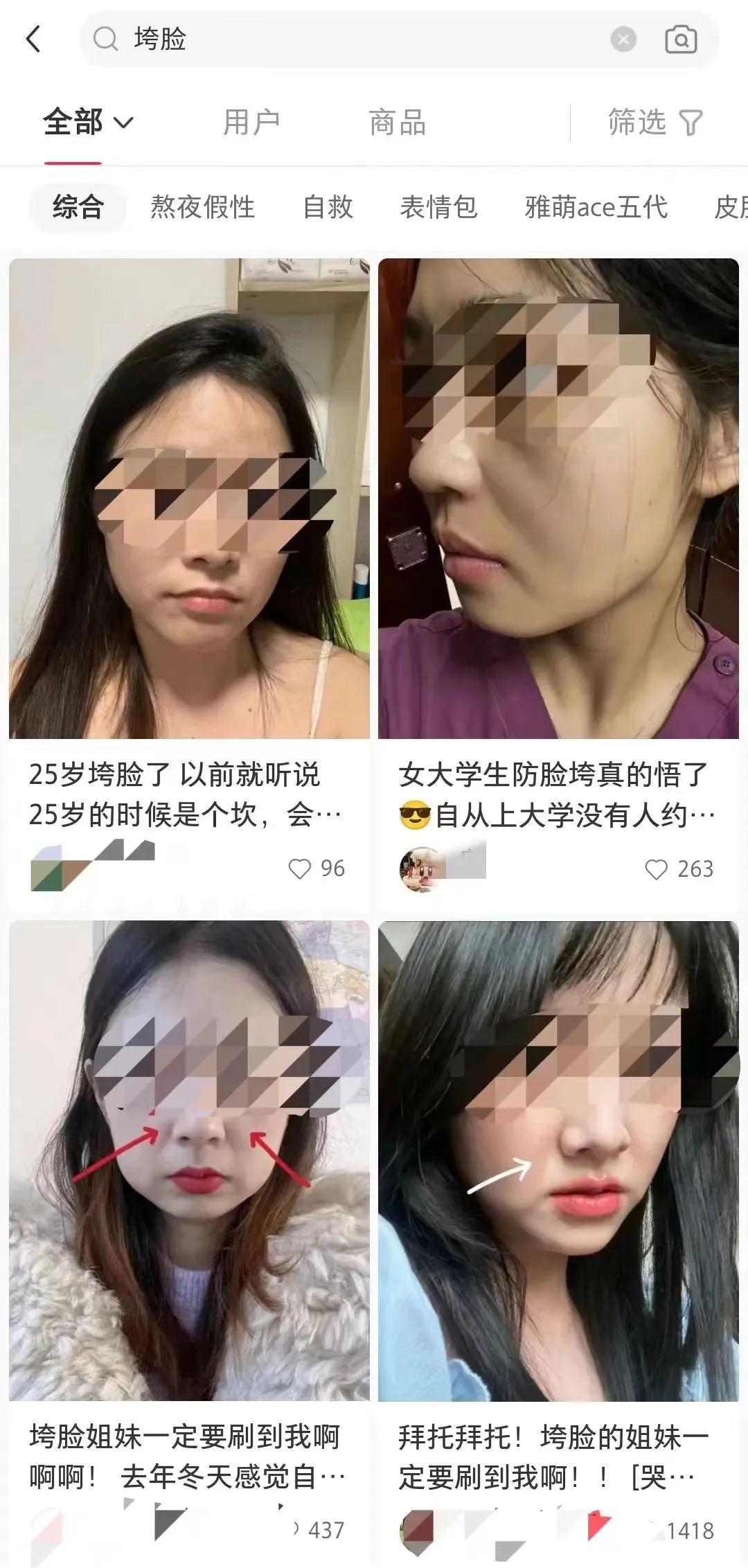 法令纹嘴角纹用产品能改善吗,脸部法令纹消除测评