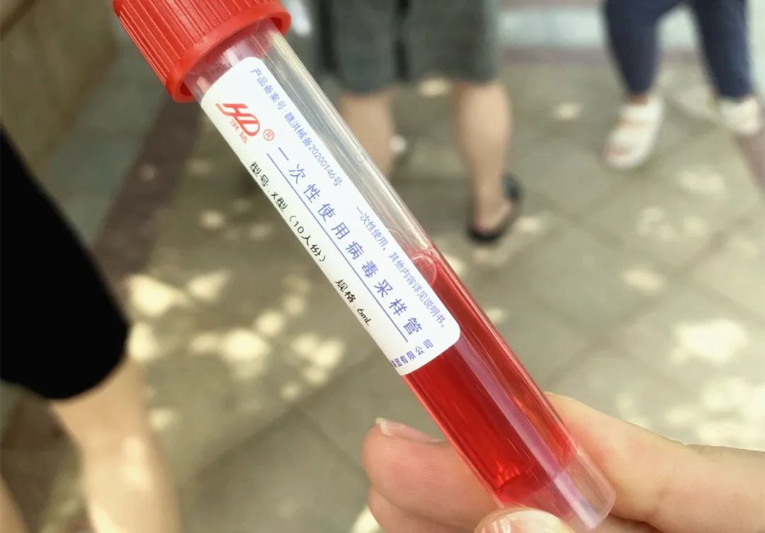 核酸检测放一个管子里的红色液体,核酸检测瓶子里红色液体