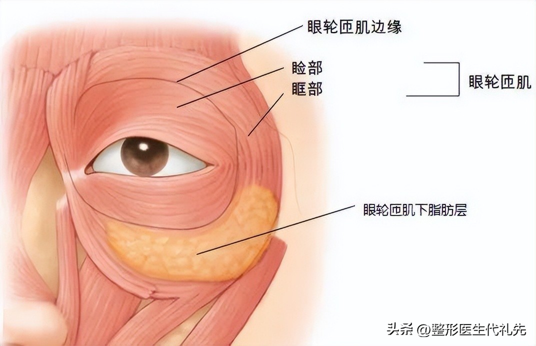 眼袋与卧蚕与泪沟的区别,做卧蚕跟眼袋的区别
