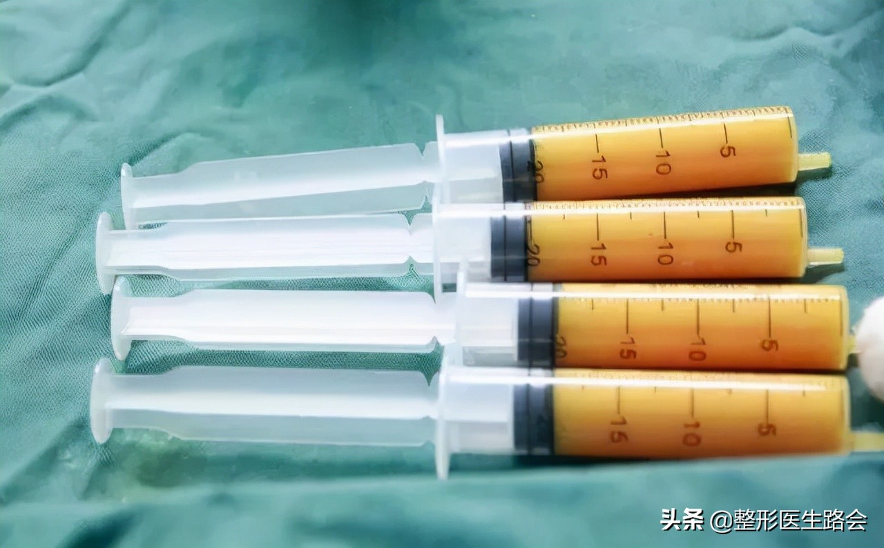 自体脂肪丰额头的危险,自体脂肪和膨体