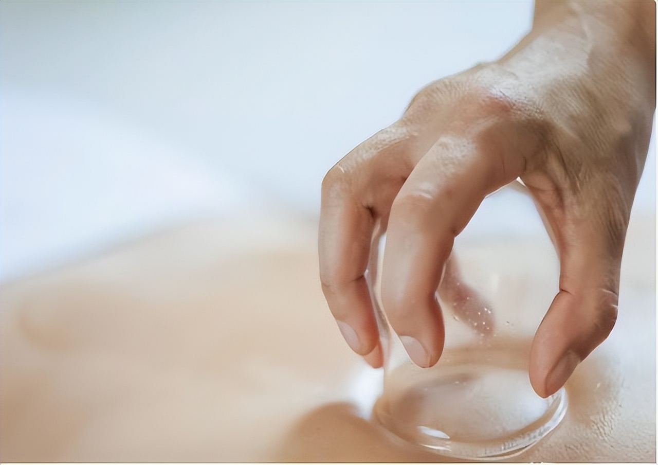 拔火罐时吸出来的淤血是毒素吗,拔火罐吸出来的瘀血是体内毒素