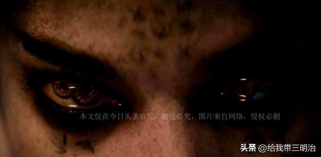 世界上有双瞳孔的人有哪些,双瞳孔的眼睛特征