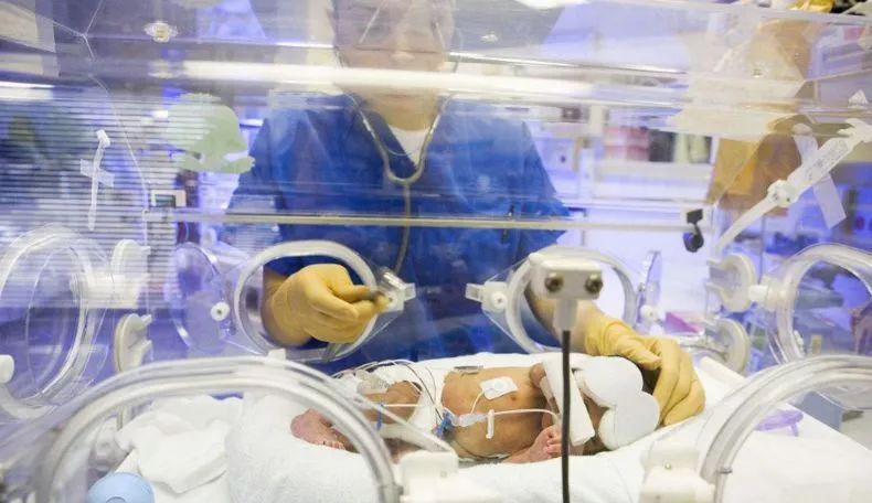 早产儿的护理与喂养小妙招,早产儿注意事项及喂养要点