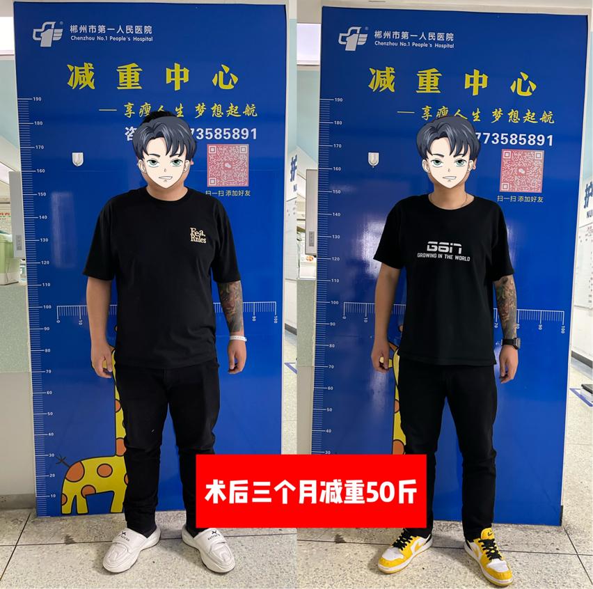 【5.11中国肥胖日】“减重手术”让你不再负“重”前行