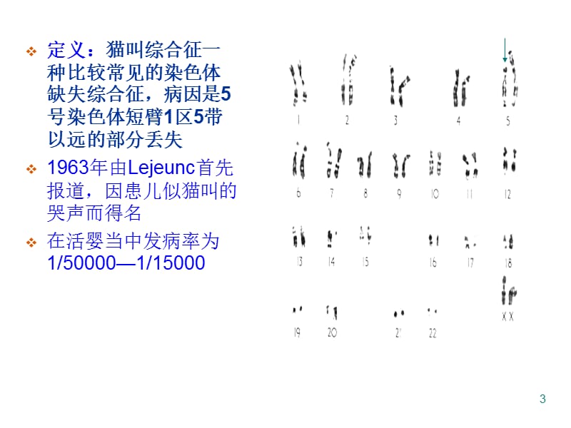 09年吉林一医生频繁听到患者发出猫叫,调查后大惊:染色体出了问题