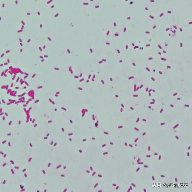 奇异性变形杆菌,奇异变形杆菌内源性感染
