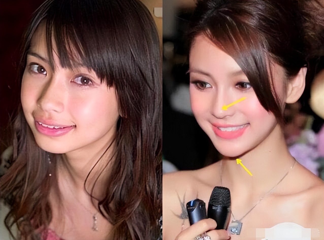 同样都是“凸嘴”，为什么有人风情万种，有人一股土味？答案在这