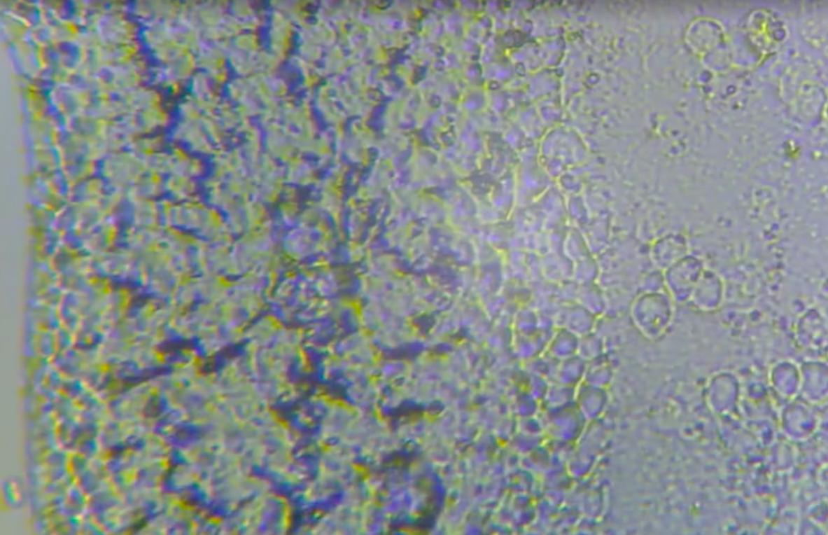 黑头白头在显微镜下怎么样,黑头可以挤出来是什么样子