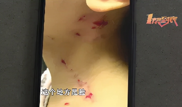 女孩被抓该如何自救,宝宝被邻居家孩子抓了