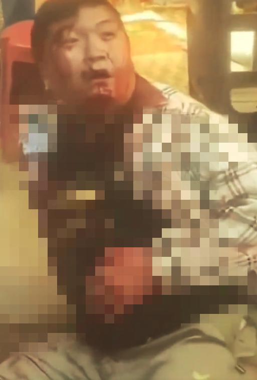 22岁网红钓鱼不慎身亡 (22岁网红钓鱼不慎中电身亡)