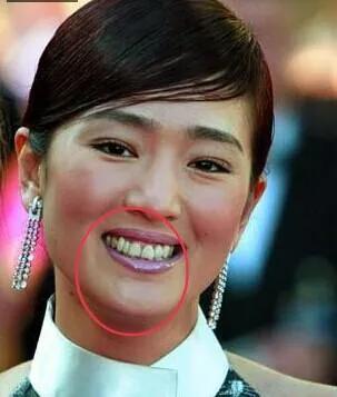 明明是绝顶大美女，却被牙齿拉胯，这15位女星苦不堪言