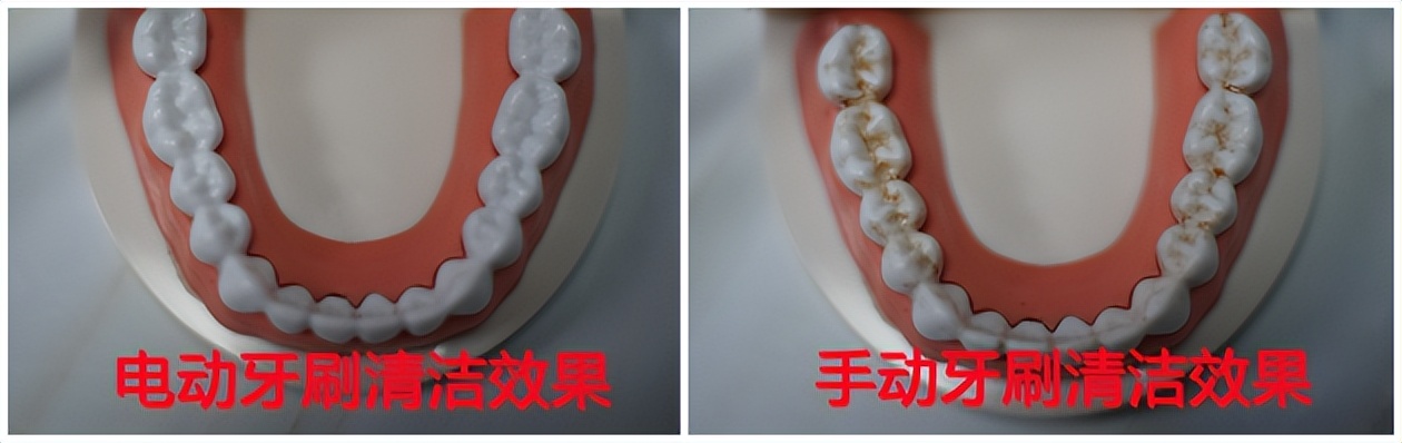 哪款电动牙刷性价比高不伤牙,儿童电动牙刷对孩子牙齿有伤害么