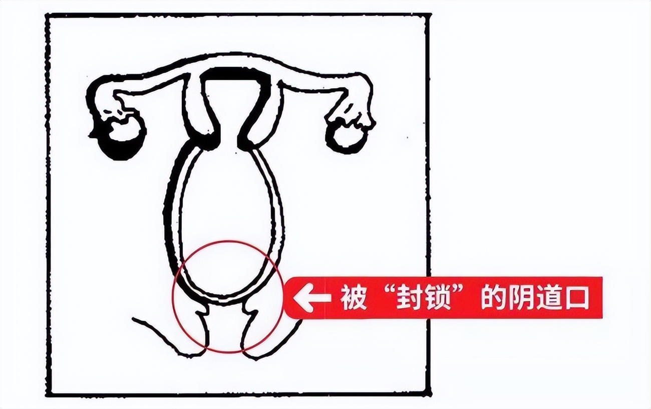 13岁女孩肠痉挛怎么回事,13岁女孩肠痉挛犯了怎么办