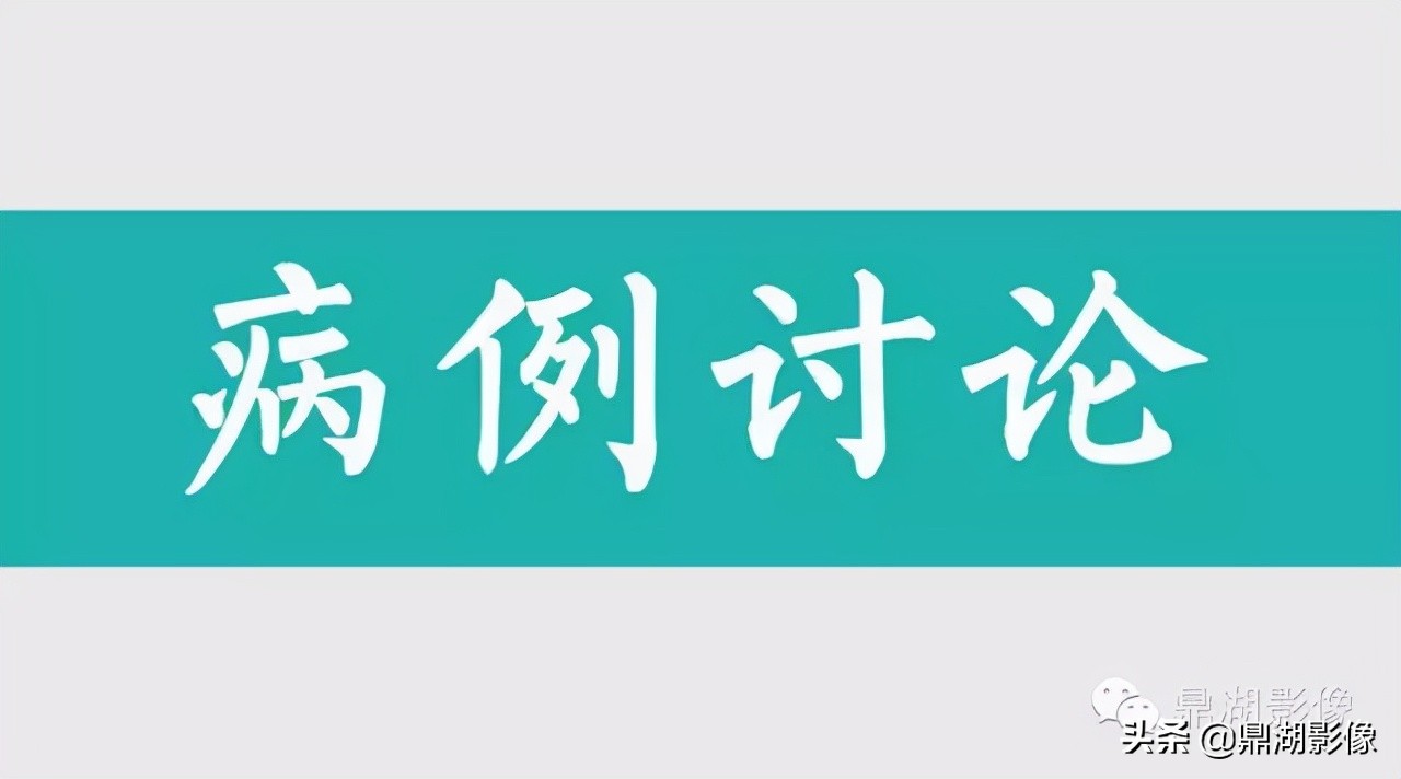 先天桡骨缺失畸形能治疗吗,先天性桡骨发育不良