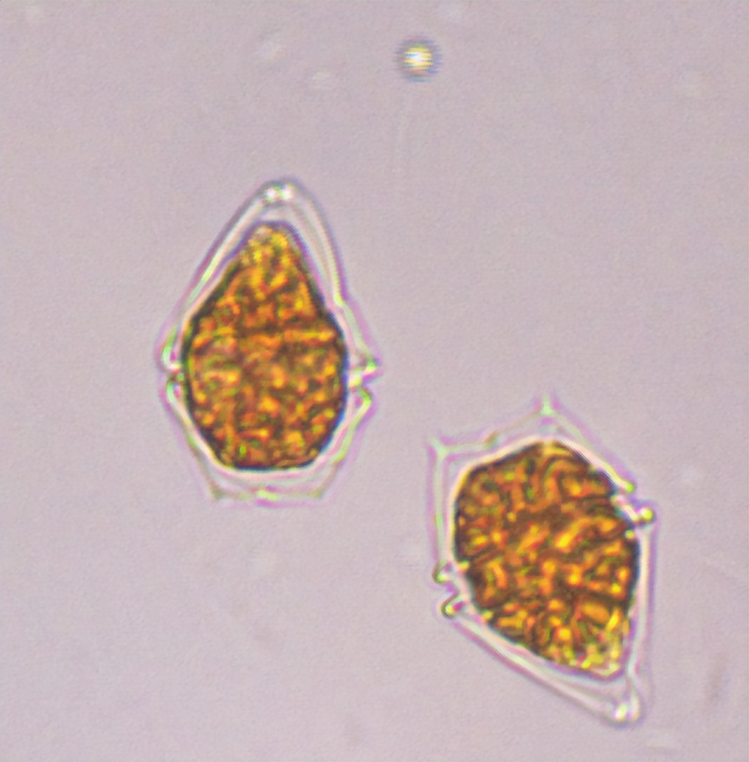 浮游植物增加会水质富营养化吗,浮游植物对水体起哪些作用