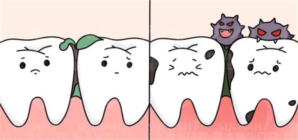 很久没刷牙有牙斑怎么去除,牙齿长了小黑点能靠刷牙解决吗