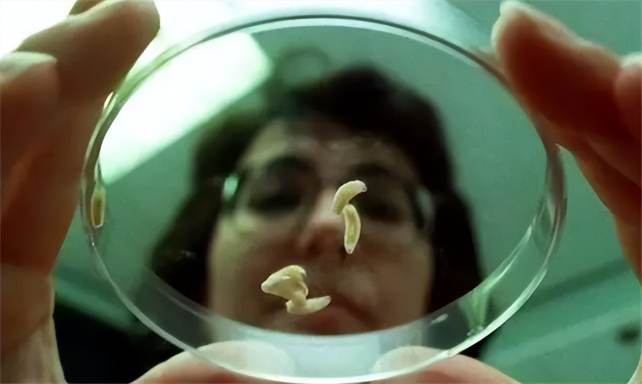 男子意外烧伤用蛆来治疗后续,小伙双腿被烧伤医生用蛆治疗