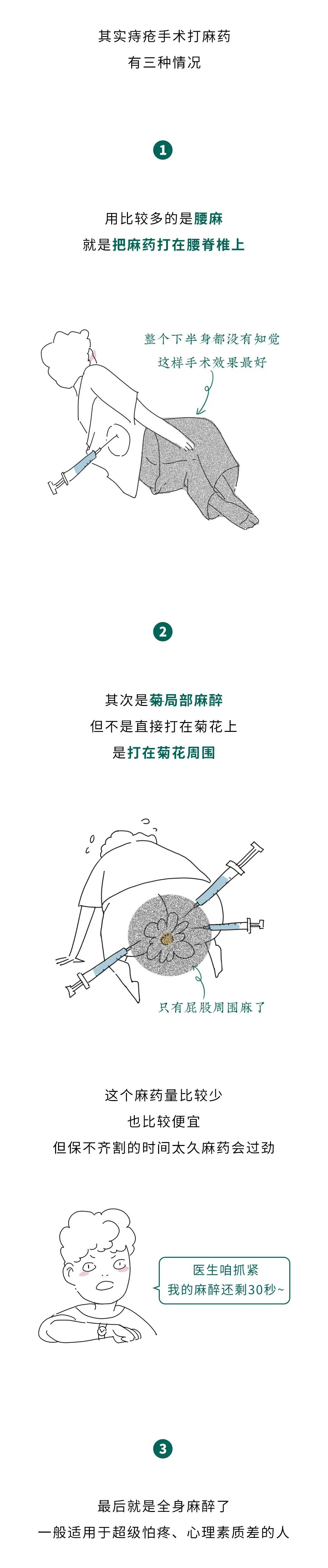割痔疮打麻药对腰有影响吗,割痔疮局麻打在哪里