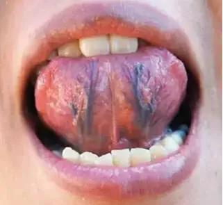 哪种益母草适合月经不调的人喝,益母草专治月经不调