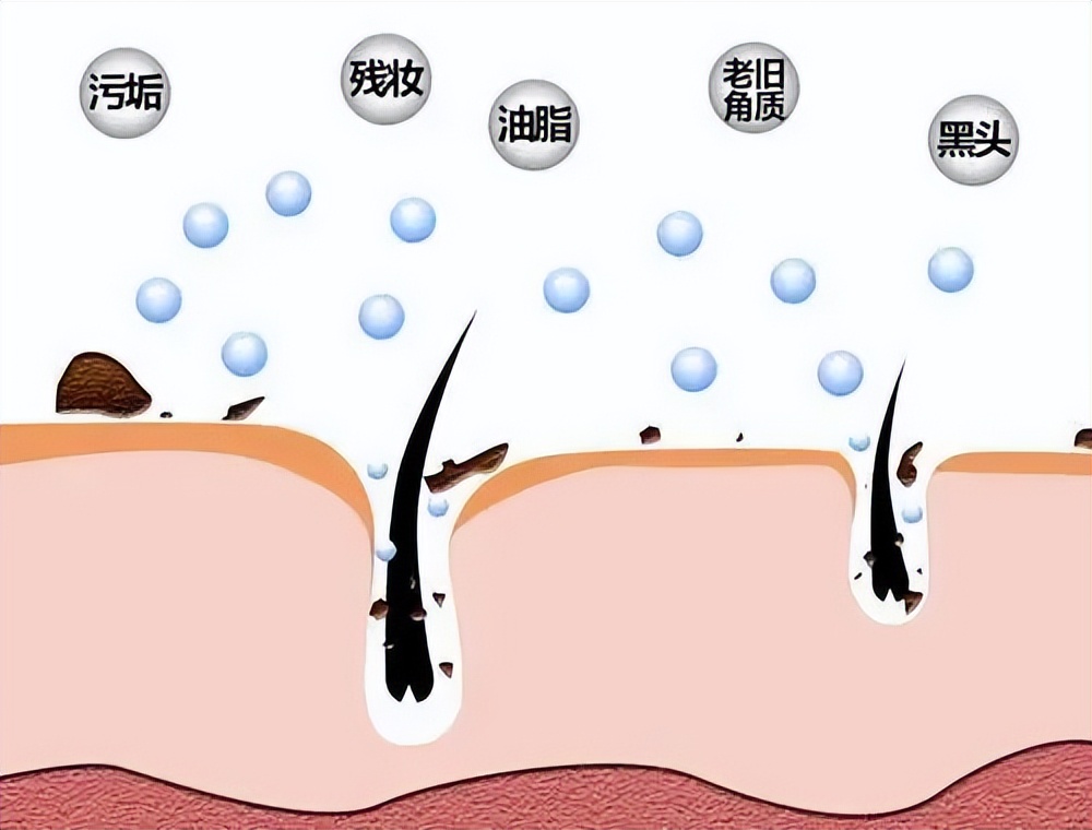 收缩毛孔粗大的方法,脸毛孔粗大的正确护肤方法