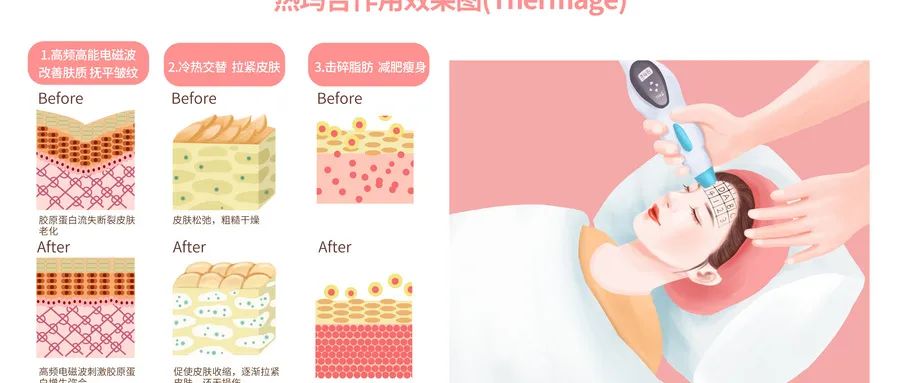 揭露美妆行业的真相,美容仪主流产品