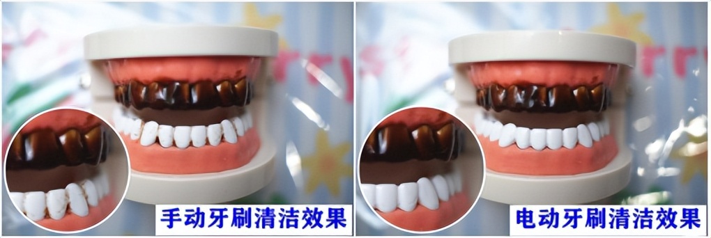 usmile和罗曼电动儿童牙刷哪个好,儿童用电动牙刷的利弊和危害