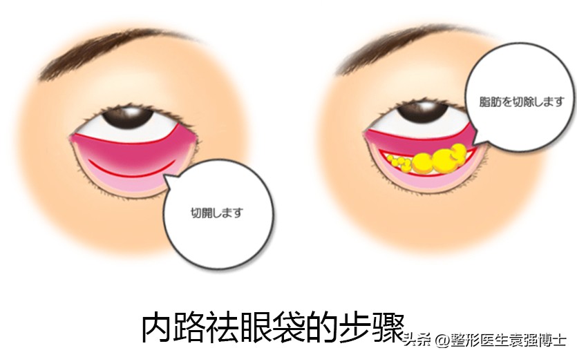 如何解决眼周衰老症状,眼周肌肤出现衰老怎么办