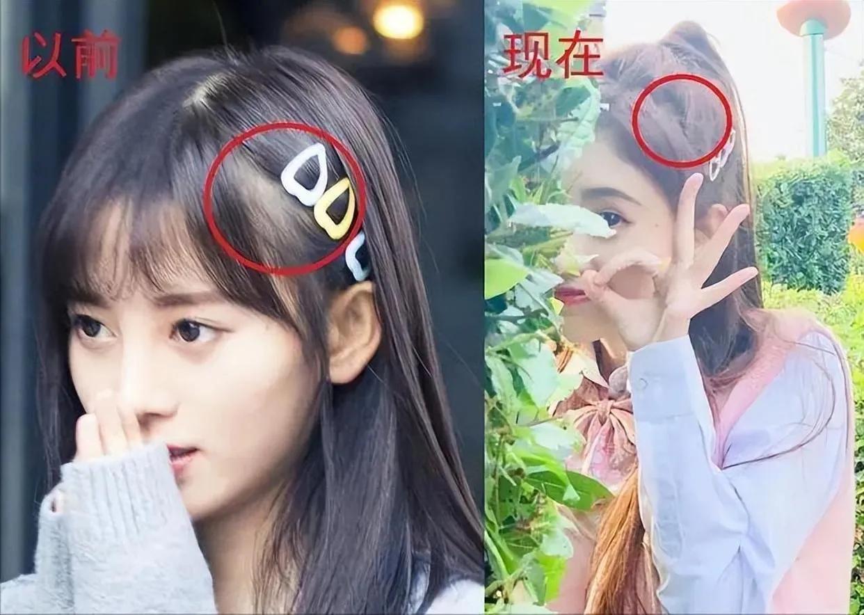 娱乐圈天然脸vs整容脸,娱乐圈没有整容的人纯天然的脸