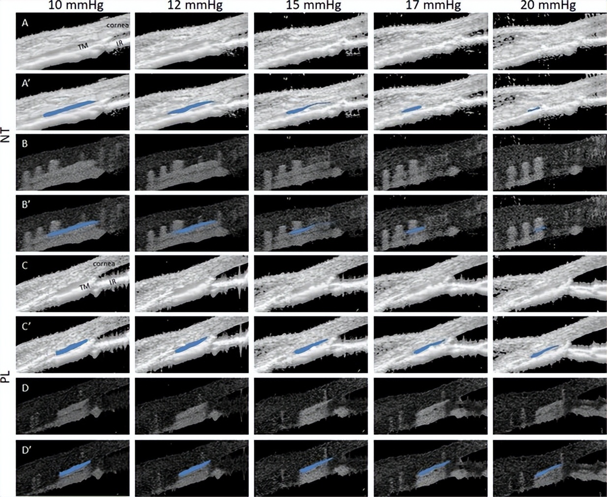 rho激酶抑制剂多少钱,rho激酶抑制剂是什么