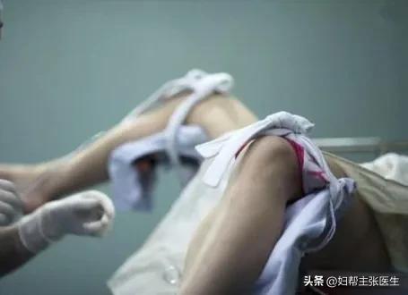 女子上环后突发剧烈腹痛，医生：需要急诊清宫。