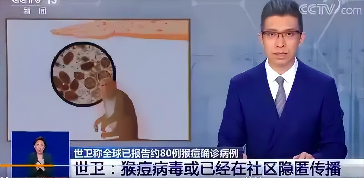 张闿作风,徐文兵猴痘病能治吗