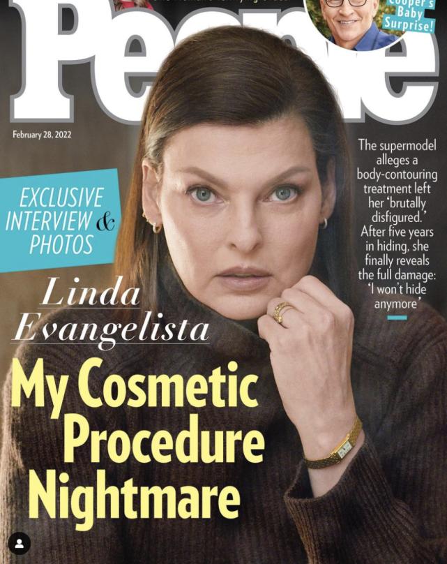 被毁容后她意外重生小说,被毁容修复好的女人