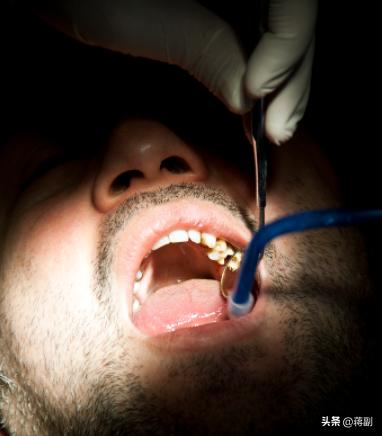 槟榔致癌为什么那么多的人吃,槟榔是明确的致癌物吗