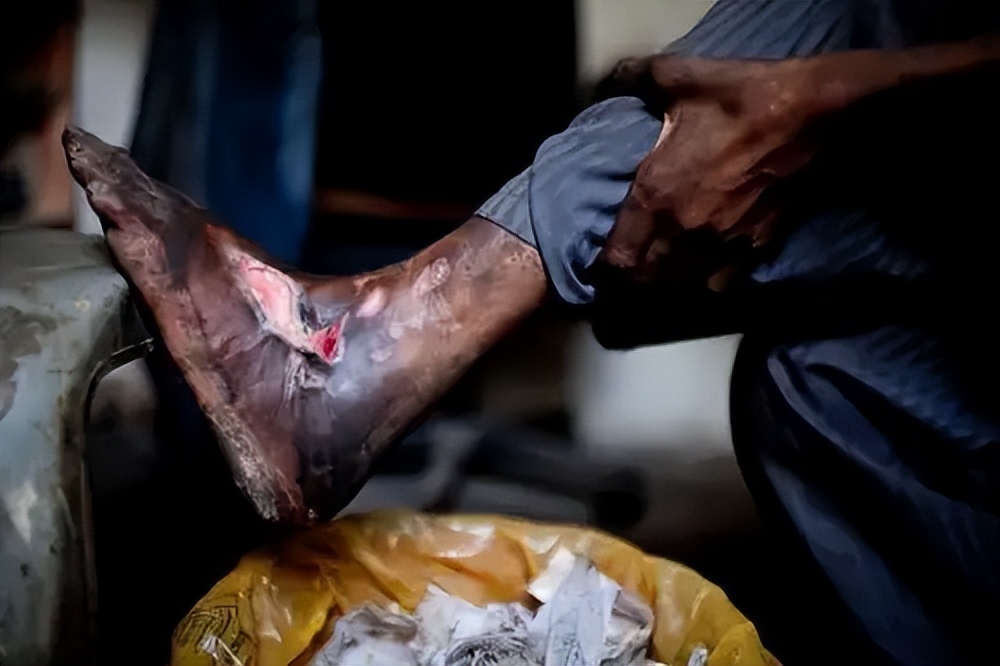 【禁毒知识】有人自杀，有人自首，吸毒的危害让人触目惊心！