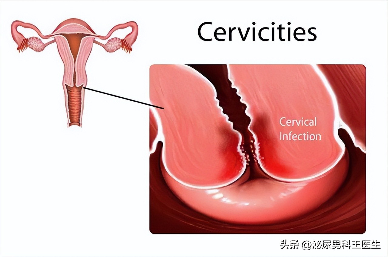 没有和女性接触的人会感染hpv吗,hpv除了性接触还有什么感染途径
