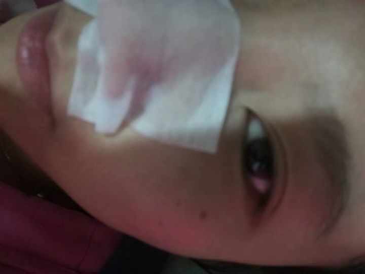 20年的黑头有多大,世界上最长的黑头到底有多长