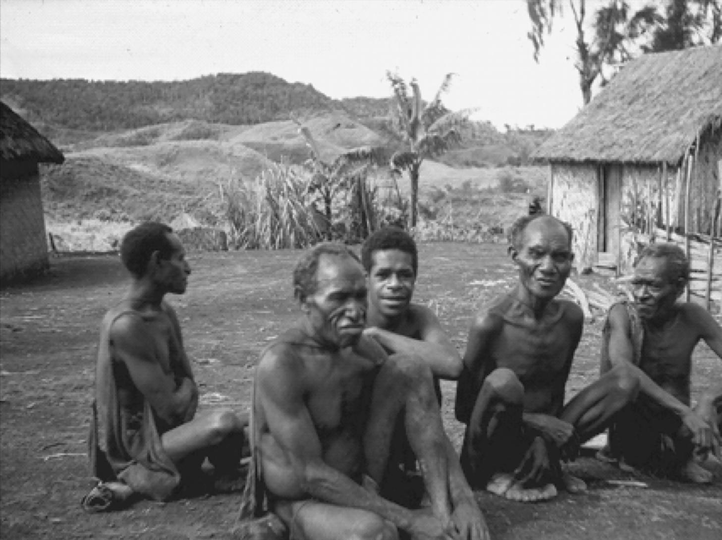 感染朊病毒有多可怕,为什么高温杀不死朊病毒