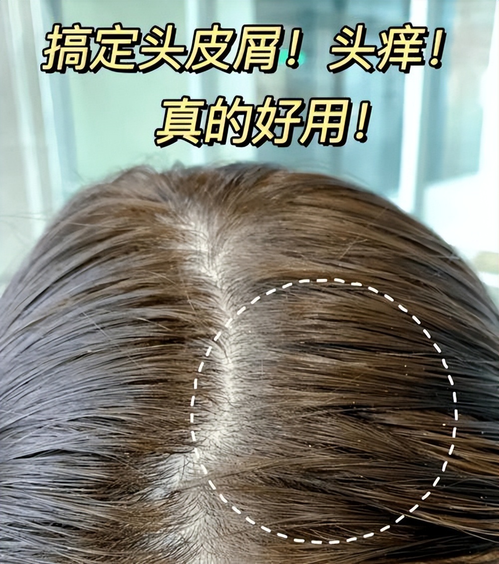 海飞丝清扬阿道夫洗发水哪个更好,洗发水是清扬的好还是海飞丝的好