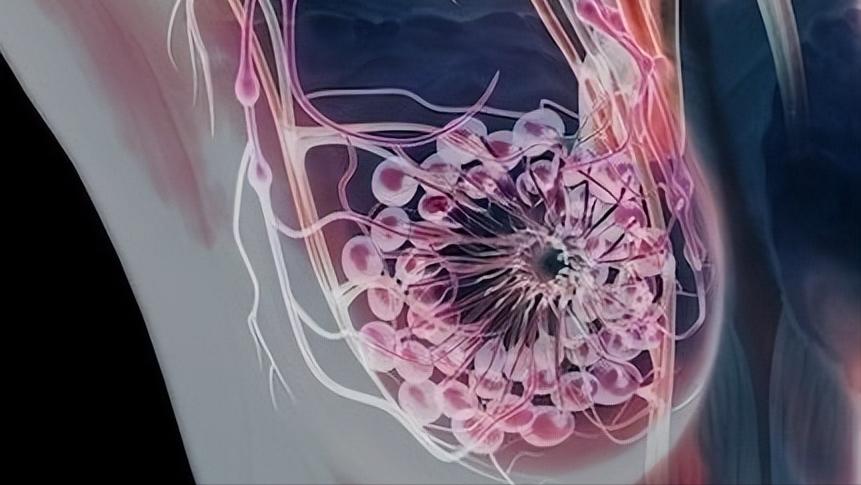 乳腺纤维瘤和乳腺囊肿的临床表现,乳腺纤维瘤手术后又长了会癌变吗