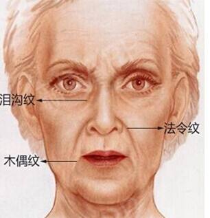 淡化法令纹逆龄抗衰,抗衰两个动作轻松淡化法令纹