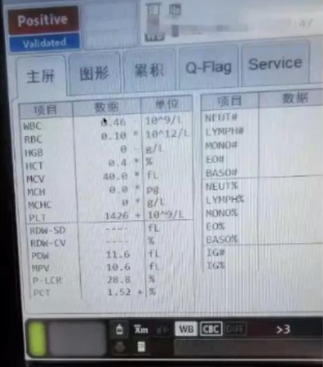 prp治疗膝关节退行性关节炎,骨性膝关节炎注射prp有效果吗