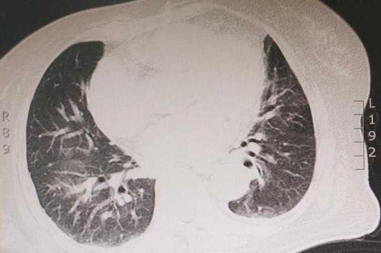 几十年间歇性胸闷气短去哪治疗,胸闷气短三年了怎么回事