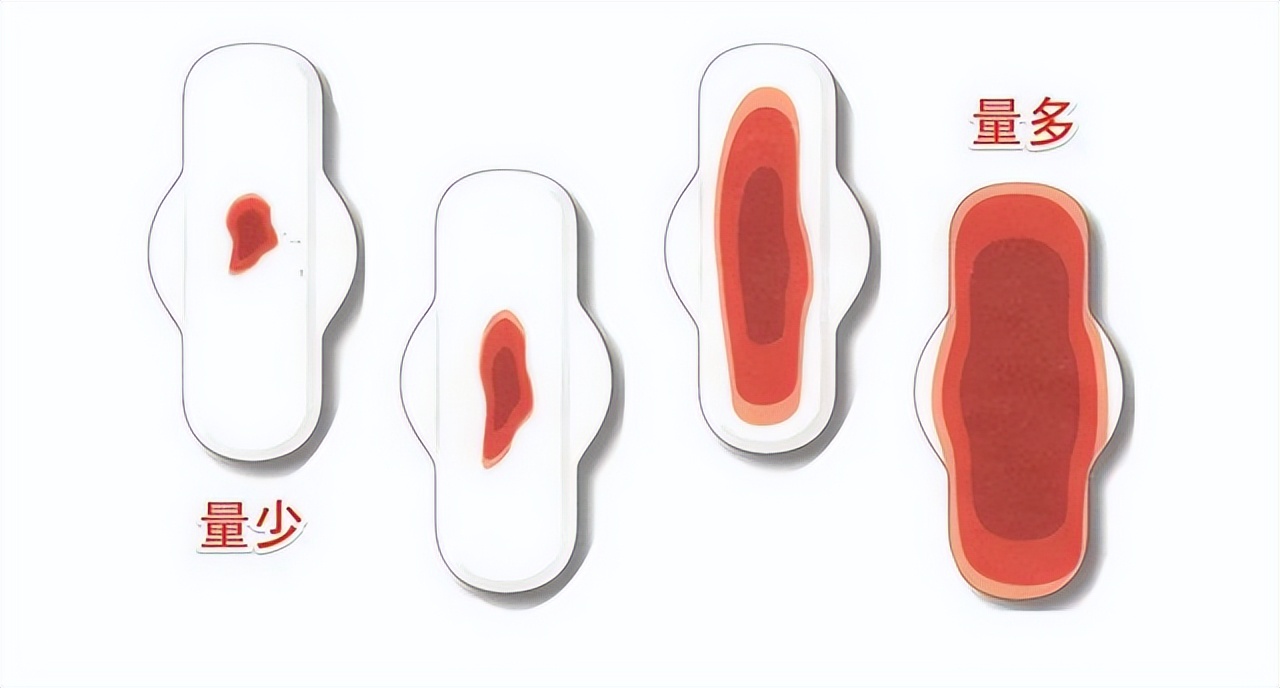 阴道不规则流血？重视身体自身预警，需要提高警惕！