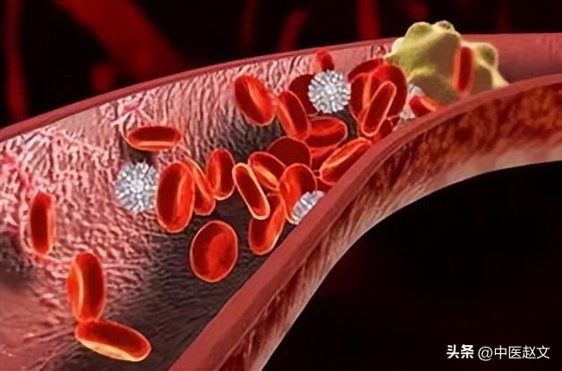 身上有瘀血？血府逐瘀丸，身痛逐瘀丸、少腹逐瘀丸到底如何选择？