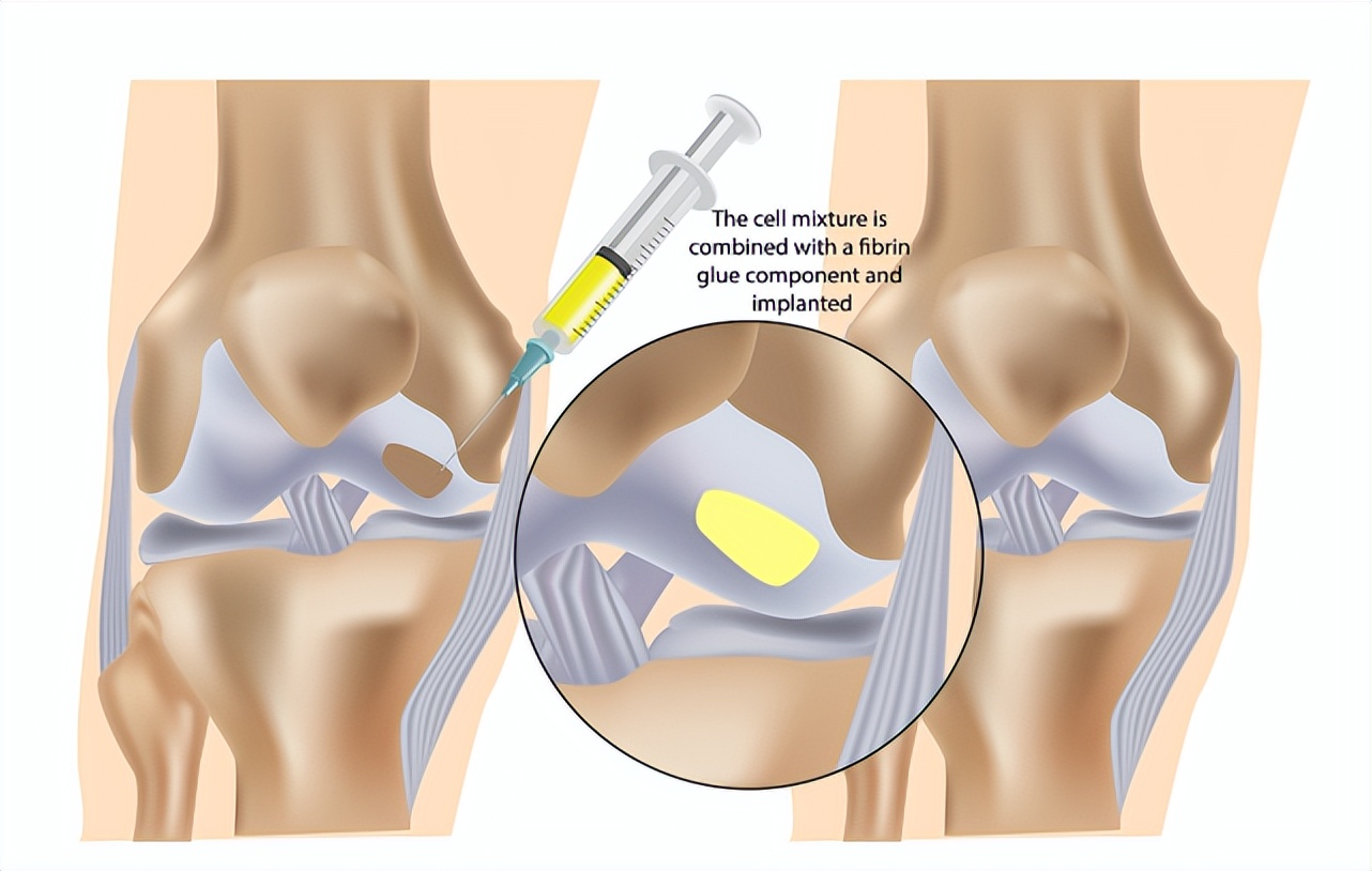 世界足球日的来源,世界足球日的由来