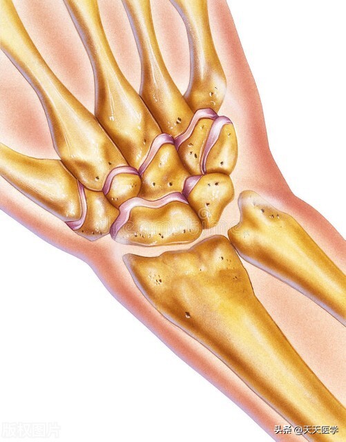 膝关节穿刺的适应症及穿刺方法,关节穿刺术适用部位