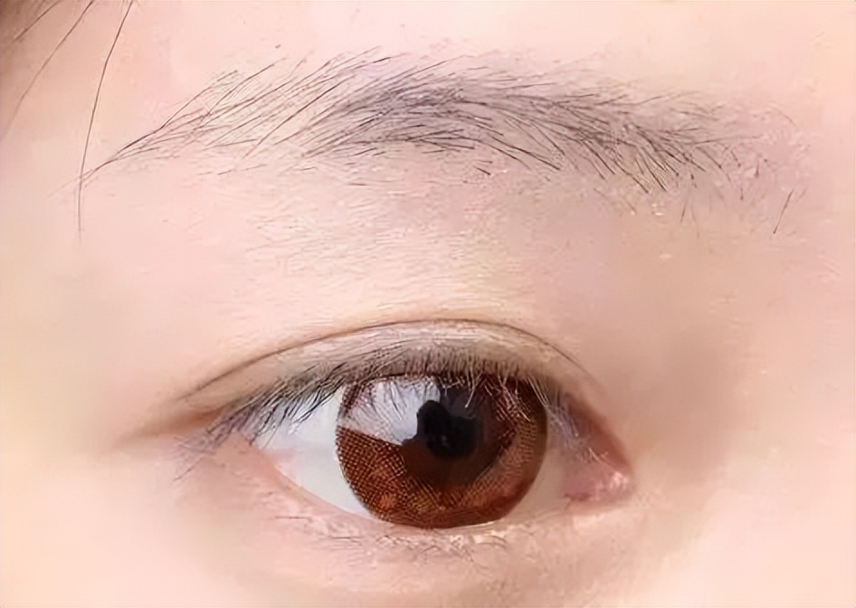 女性体毛重的症状都有什么,女性体毛生长旺盛与哪些原因有关